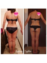 グレイスボディ BiViつくば店(Grace Body)/ボディ＋超音波機器症例写真