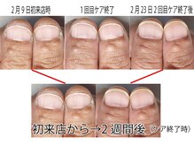 マムコレクション/自爪育成/地爪育成/美爪育成