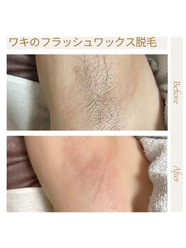 オフオルファヴォリ(OF Olu:Favori)/【フラッシュワックス脱毛】