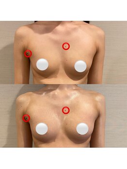 IBC 上大岡店/beforeーafter