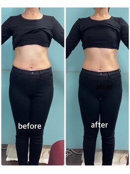 トトノエル 下伊福院/フェムケア