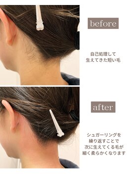 サロンドベルム(Salon de BELME)/シュガーリング:before/after