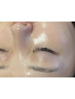 毛穴ケアをしたい