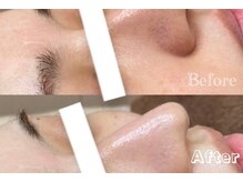 ラポール 野並店(Rapport)/