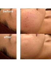 プルームドゥクレ(plume de cle')/