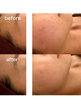 プルームドゥクレ(plume de cle')/