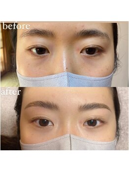 アトリエリン 小牧本店(Atelier Rin)/ハリウッドブロウリフト