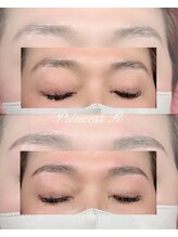 プリンセスアール(Princess R)/美眉トータルケア