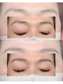 プリンセスアール(Princess R)/美眉トータルケア