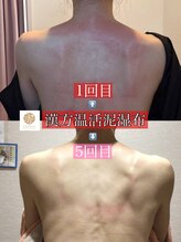 フェアリー 小松店/NEW!漢方温活泥湿布でデトックス