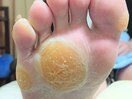 ◆ドイツ式トータルフットケア☆