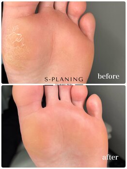 サロン ド ネイル 椿(Salon de nail 椿)/韓国式角質ケア