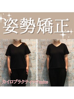 ミーテ(mite)/歪みの改善