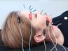 【美容鍼】リフトアップ美容鍼60分¥3500