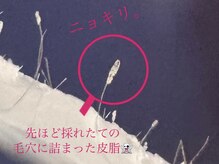 ムゥ(Mwoo)/フェイシャルワックス/顔脱毛