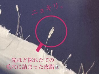 ムゥ(Mwoo)/フェイシャルワックス/顔脱毛