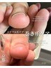【巻き爪に悩まれている方へ】親指巻き爪ケア(1本)＋爪カット11000円→6000円