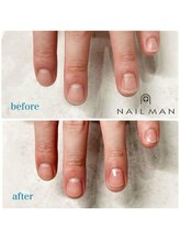 ネイルマン 横浜店(Nail Man)/ハンドケアのビフォー＆アフター
