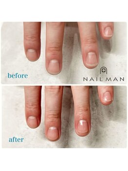 ネイルマン 横浜店(Nail Man)/ハンドケアのビフォー＆アフター