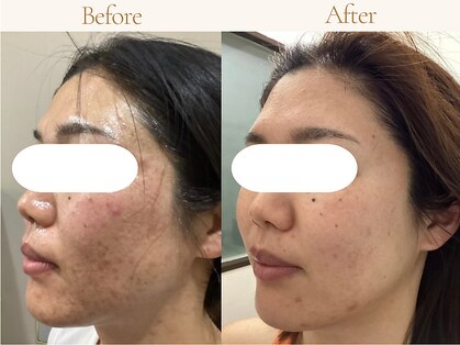 ルボン(RUBON)の写真