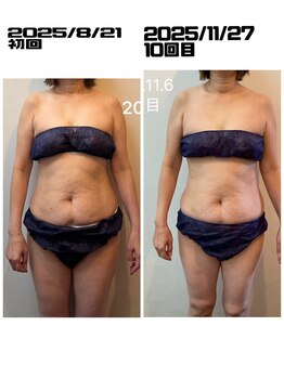 鍼灸整骨院ナガサキ(nagasaki)/ウルトランスフォーマー