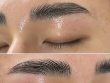 カーム(Calm)/ハリウッドブロウリフト