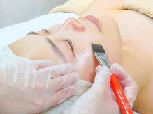 ビービージー(BBG)