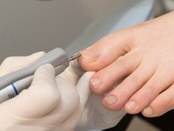 【看護師×ドイツ式フットケア】フスフレーゲ Foot　Nes　大山店【4/15 OPEN(予定)】の写真/痛い魚の目・ガサガサ角質を根本ケア！看護師による精密なドイツ式ケアで、驚くほど滑らかで柔らかな足裏へ