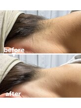 メゾン ド クロエ(Maison de Chloe)/ブライダルシェービング