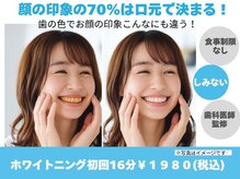 歯のホワイトニング 岐阜アクティブG店