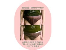 スターポルト(Star-Porte)の雰囲気（体・肌・心が自然と変わる。Bf～Afの違いが分かる施術が得意です）