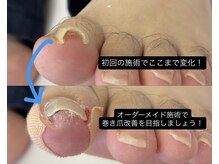 巻き爪じゅん 千葉駅前店の雰囲気（他店で改善しなくても諦めないで！当院で改善しましょう！）