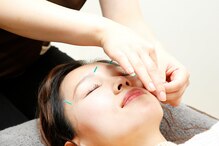 おざき鍼灸整骨院 美容鍼灸サロンOZAKI 西宮北口店