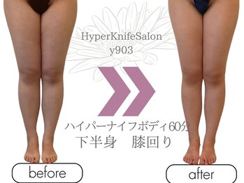 ワイキューマルサン(y903)/ハイパーナイフボディ60分下半身