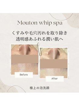 アジュール(a jour)/ムートン泡スパビフォーアフター