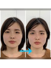 ストレッチヒーロー 福山春日店/むくみが無くなった！