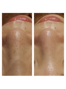 ルピナス(Lupinus.)/ビフォーアフター写真★