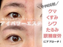 ショコラッシュ(Shocolash)