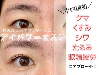 ショコラッシュ(Shocolash)