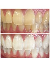 ホワイトニングルーム 横浜店(Whitening Room)/ホワイトニング/横浜