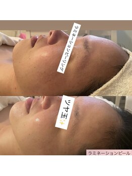 ヨノ(Yono)/艶玉ゲット☆