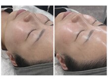 ココ(COCO)の雰囲気（渡韓不要の水光ツヤ肌◆痛み、ダウンタイムなしの施術◎）