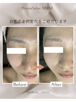 シレーヌ(Sirene)/ハンドマッサージピーリングケア