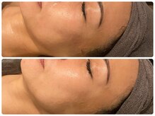 ラルミエール 緑店はなれ(la lumiere)