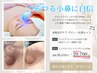 【1.5カ月集中!毛穴ケア】毛穴洗浄ハイドラ50分3回+弱酸性洗顔料セット