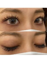 クリアーズ ビューティー(CCLEAR’S BEAUTY)/バインドロック