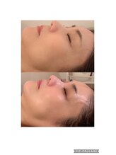 ベリンダ(BELINDA)/結果にこだわるフェイシャルケア