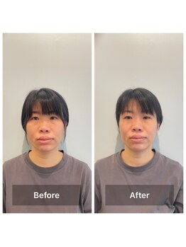 美容整体プラスフィール 横浜店/美容整体/エステ/リラク