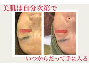 ヴィヴ コレビ(VIV COREBI)/悩み改善