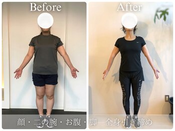 ロア(LORE)/ビフォーアフター